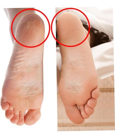 minkissy 2 Pairs High Heel Protectors Moisturizing Socks Silicone Socks Silicone Moisturizing Socks Heel Socks for Cracked Heels Moisturising Gel Socks Foot Socks Insole Heel Cover Elastic - Buy Online on GoSupps.com