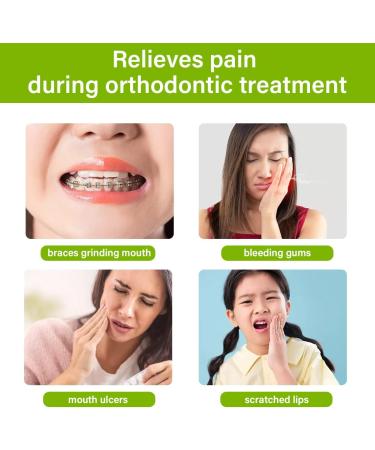 Orthodontic Wax for Braces - 10 Pieces & 50 Stripes | Relieve Irritation & Pain - White Dental Wax - Buy Online on GoSupps.com