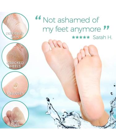 Shop Callus Socks & Foot Masks - Effective Callus Remover & Foot Care Set for Smooth Feet - International Shipping Available - Buy Online on GoSupps.com