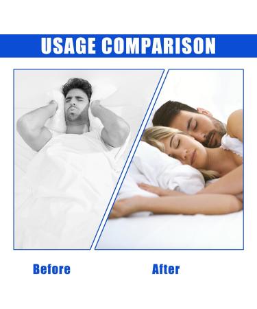 Adjustable Anti-Snoring Chin Strap for Deep Sleep | Breathable & Comfortable | Stop Snoring Solution for Men, Women & Kids - Buy Online on GoSupps.com