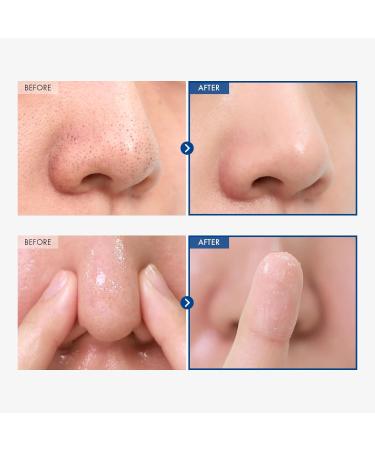 AHA Blackhead Out Cleansing Oil - Tea Tree & Jojoba Oil Makeup Remover | Gentle Korean Face Cleanser for Blackhead & Pore Removal 150ml - Buy Online on GoSupps.com