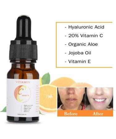 Natudeco 10ml Vitamin C Serum Whitening Face Essence Moisturizing Serum Skin Care Treatment for Facial Firming Hydrating Whitening Skin Dark Spot Remover - Buy Online on GoSupps.com