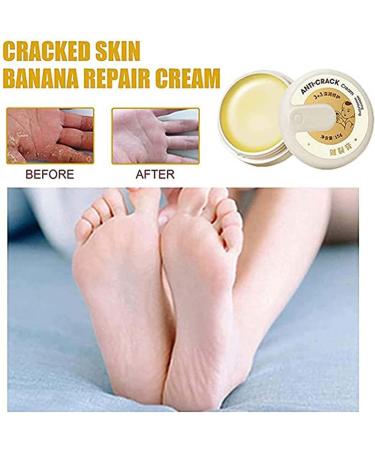 Cr me anti-d chirure pour peau d'hiver R paration Main Pied Se Soucier Exfoliant Cr me Anti Engelures Sec Fissures Et Fissures Gu rir Pommade Cr mes Pieds Anti-Crevasses - Buy Online on GoSupps.com