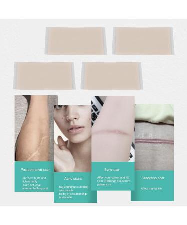 SILICONE SCAR SHEETS | Professional Gel Patch for Scar Removal, Stretch Marks, Keloids | C-Section & Stomach Pads for Men & Women - Skin Care Stickers - Buy Online on GoSupps.com