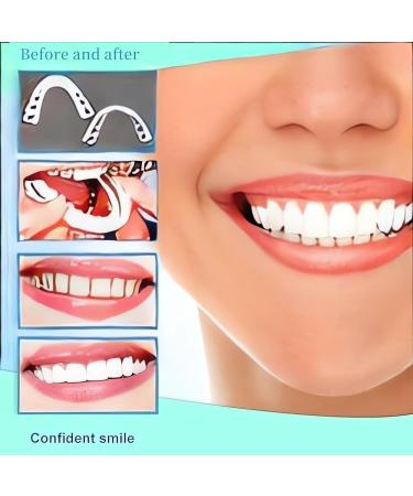 2 Pairs Adjustable Confident Smile Dental Aligners for Men & Women - White | Best International Shipping - Buy Online on GoSupps.com