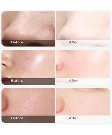 Cr me de traitement correcteur de couleur masque correcteur de couleur masque l'acide salicylique nettoyage en profondeur retrait des pores masque hydratant et rafra chissant (1 pi ce) 1 pi ce. - Buy Online on GoSupps.com
