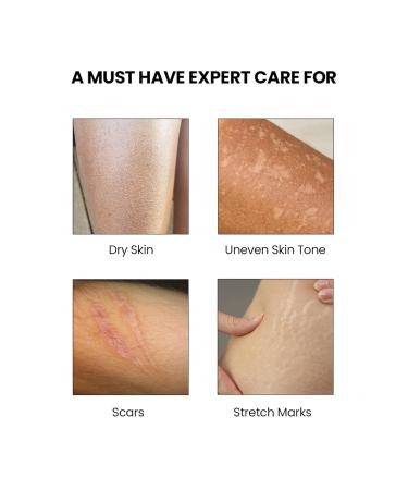 AM Skincare Oil suitable for Stretch Marks | Scar Removal | Uneven Skin Tone | Vitamin E | All Skin Types | 80ml - Buy Online on GoSupps.com
