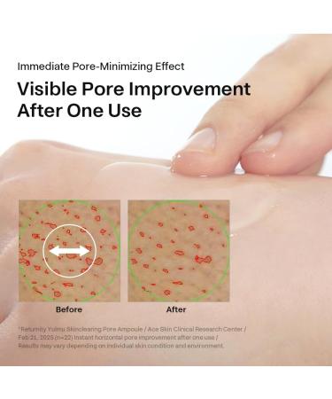 RETURNITY Yulmu Skin Brightening Ampoule with Coix Seed Extract and Madecasoside for Sensitive Skin, Korean Beauty Face Serum - Buy Online on GoSupps.com