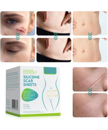 Premium Silicone Scar Removal Band - 1.6 x 60 Rolls | Effectively Treat Old & New Scars Keloids & Acne Scars - Fast International Shipping - Buy Online on GoSupps.com