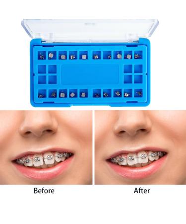 Dental Orthodontic Self-Ligating Metal Brackets - ROTH 022 3 with Hooks | Premium Passive Dental Metal Braces for Global Shipping - Buy Online on GoSupps.com