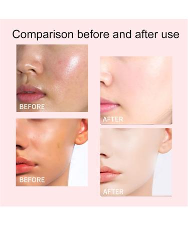 1/2/3/4/5Pcs Essence Glow Serum 30ml Essence Watermelon Glow Serum Glow Watermelon Moisturizer Essence Glow Serum Watermelon Glow Boosting Serum Moisturizing Brightens Skin for All Skin Types (1pcs) - Buy Online on GoSupps.com