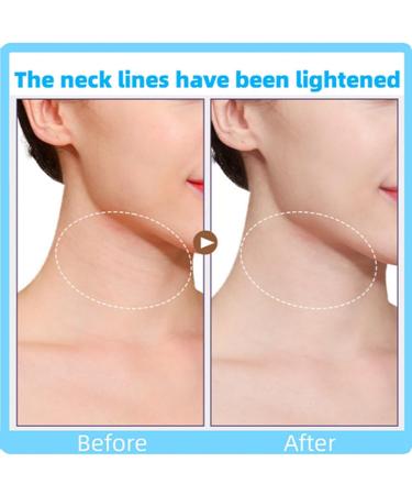 Neck Strips Neck Tape Lifting Invisible Tightening Tapes and Bands Lifter for Wrinkles Neck Makeup Patches Lifting Saggy Skin Neck Line Remover Slimmer (transparent10 PCS) 10pcs clear neck lift tape - Buy Online on GoSupps.com
