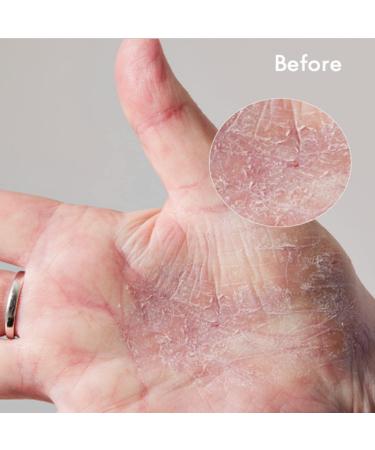 Lanolips Everywhere Cream (85 ml) 101 Dry Skin Super Cream (60 ml) Ultra Hydrating Multi Use Bundle for Face & Body - Buy Online on GoSupps.com