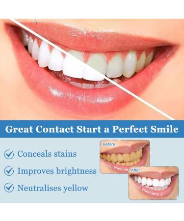 Teeth Whitening Gel | Instant Stain Removal & Color Boost | Upright White Tooth Polish - International Shipping Available - Buy Online on GoSupps.com