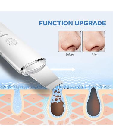 Skin Scrubber Face Spatula Professional Blackhead Remover Pore Cleaner Scrubber Spatula Exfoliator with 4 Modes for Deep Cleansing Skin Care Tool - Buy Online on GoSupps.com
