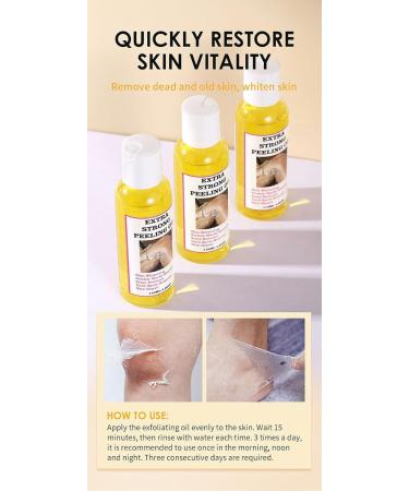 Extra Strong Yellow Peeling Oil Yellow Peeling Oil Extra Strong Peeling Oil for Dark Skin Extra Strong Peeling Oil Extra Strength Exfoliating Peeling Solution for Body Dead Skin Remover (3PC) - Buy Online on GoSupps.com