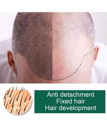 Revitalize Hair Growth Serum | Anti-Hair Loss Foam for Men & Women | Boost Thin Hair & Root Strength - Buy Online on GoSupps.com