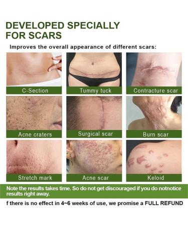 Goopgen Advanced Scar Repair Serum 30ML - Nature Scar Treatment - Scar Removal Serum for All Types of Scars (1PC) - Buy Online on GoSupps.com