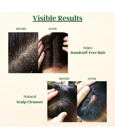 Buy Cultivator's Anti-Dandruff Hair Mask | Deep Conditioning Treatment for Dry & Itchy Scalp | Hydrating Organic Leave-in Repair Mask - International Shipping - Buy Online on GoSupps.com