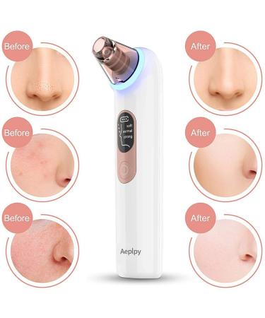 Blackhead Remover Vacuum - Electric Facial Pore Cleaner with 4 Suction Heads for Acne Comedone Extraction and Pimple Removal Kit - Buy Online on GoSupps.com
