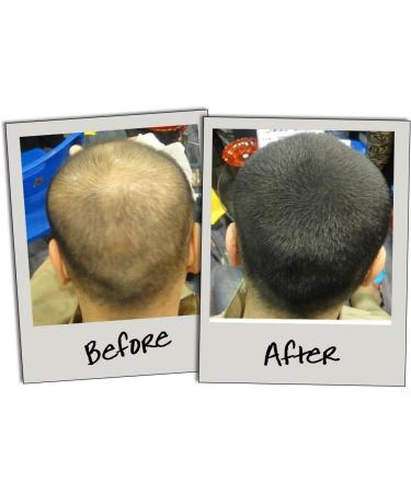 3D Hair Fibres Medium Brown 10g | Natural Hair Thickening Solution for Fuller Locks - Buy Online on GoSupps.com