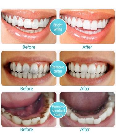 Allouli Teeth Mousse Foam Toothpaste | Teeth Whitening Stain Removal & Fresh Breath - Shop Now! - Buy Online on GoSupps.com