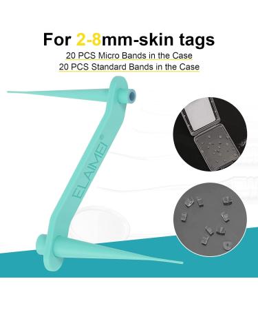 2-in-1 Skin Tag & Mole Remover Kit - Safe & Painless Removal for 2mm-8mm Sized Tags - Easy DIY at Home Green - Buy Online on GoSupps.com
