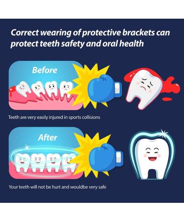 Vanmor 6 Pack Youth Mouth Guard for Kids - Double Colored Teeth Braces with Case - Ideal for Football, Basketball, MMA, and More - Moldable Mouthpiece for Boys and Girls - Buy Online on GoSupps.com
