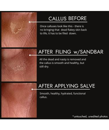 SandBar Natural Callus Salve - Revitalizing Callus Balm for Healing & Nourishing Calluses - On-the-Go Repair & Care - Immediate Relief for Callus Tears - 0.15 oz - Buy Online on GoSupps.com