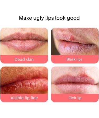  Fyearfly Lip lightening for dark lips lip balm to remove dark lips moisturizing and brightening lip balm for nourishing repair - Buy Online on GoSupps.com