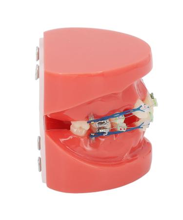 Buy GFRGFH Dental Model with 24 Teeth - Half Metal Half Ceramic Bracket for Teaching & Study - International Shipping Available - Buy Online on GoSupps.com