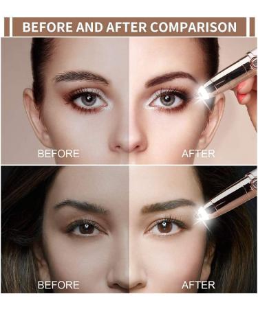 SiKii Eyebrow Hair Remover - Painless Precision Trimmer with LED Light (Rose Gold) | Facial Hair Removal for Women and Men - Buy Online on GoSupps.com