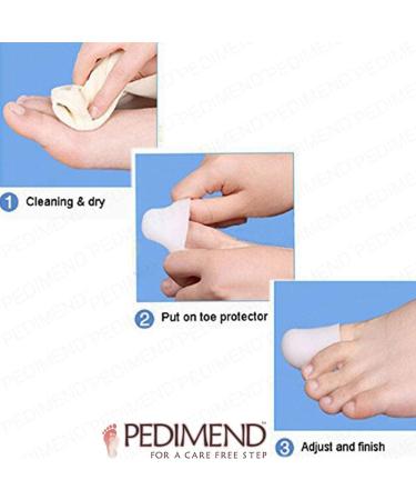 Pedimend Soft Silicone Big Toe Caps - Toe Nail Protector Sleeve for Ingrown Nails - Prevent Corns, Calluses, and Blisters - Foot Care (1 Pair) - Buy Online on GoSupps.com