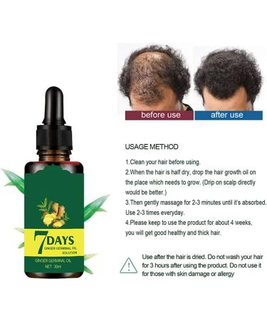 Hair Growth Serum Ginger Germinal Oil Anti Hair Loss Hair Serum Hair Loss and Thinning Hair Treatment Promotes Thicker Hair Growth - Buy Online on GoSupps.com