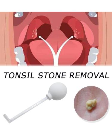 Tonsil Stone Removal Tool - Manual Style Cleaner for Adults | Oral Care Mouth Cleaning - Buy Online on GoSupps.com