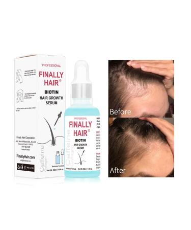 Women's Hair Loss Treatment Serum with Biotin, Collagen, and Caffeine - Promotes Hair Growth and Supports Regrowth - Buy Online on GoSupps.com