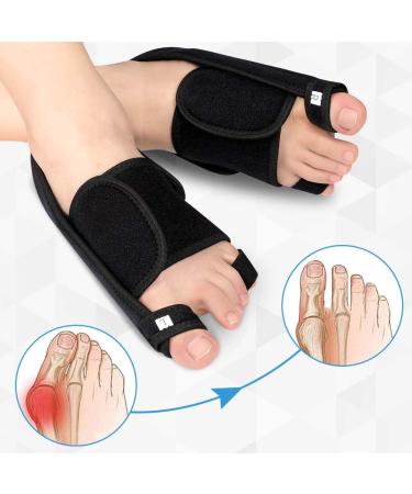 Doact Bunion Corrector Rail | 3D Printed Hallux Valgus Orthosis for Men & Women | Overlapping Toe Solution - Buy Online on GoSupps.com