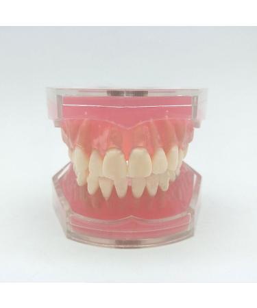 Standard Dental Teeth Model - Removable Full Mouth Resin Crown Model for Tooth Extraction & Patient Explanation - Buy Online on GoSupps.com