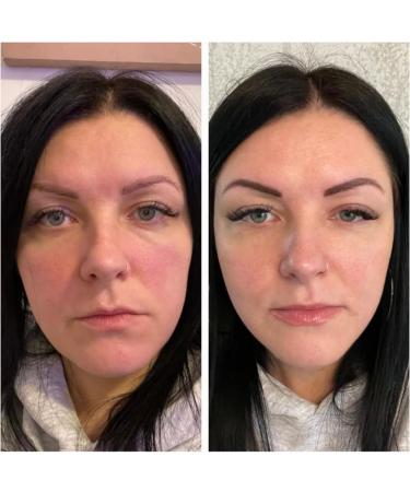 Oh My Skin: Exfoliating Smoothing Brightening & Hydrating Clinical Home Therapy Gel Cream. Enzyme Technology perfect for Pore Refinement Fine Lines Acne Blemishes & sensitive skin. Made in UK - Buy Online on GoSupps.com