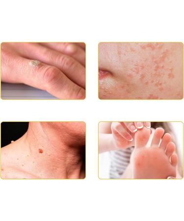ZVLZVL Bee Venom Skin Treatment Cream - Fast & Effective Repair for Men & Women | 1 Fl Oz - Professional Skin Care Solution - Buy Online on GoSupps.com