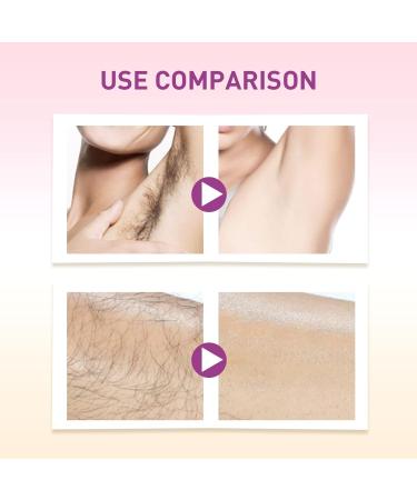 Spray D pilatoire for Tout Le Corps (Mains Jambes Aisselles) - Inhibe La Pousse des Poils Et Laisse La Peau Douce Et Soyeuse(3PCS) - Buy Online on GoSupps.com