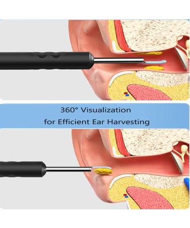 Ear Wax Removal Kit with Camera and Light - 1080P Ear Camera for iOS & Android - Includes 7 Silicone Ear Spoons and 2 Spiral Ear Wax Removers - Buy Online on GoSupps.com