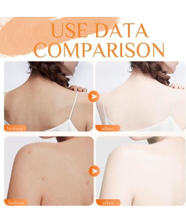 Turmeric Body Scrub - Body Scrub Exfoliator - Fade Dark Spots Body Exfoliator Scrub - Deep Cleansing Body Skin Care - Face Scrub Exfoliator - Brighting Moisturizing Nourishing 150g - Buy Online on GoSupps.com