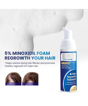 5% Minoxidil Foam Hair Growth Serum - Men & Women - 2 Month Supply - Promotes Regrowth & Thickens Hair - Buy Online on GoSupps.com