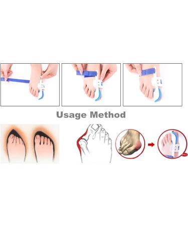 HiiBaby Night Time Splint Big Toe Straightener Bunion Hallux Valgus Corrector Regulator Stretcher Support Separators Foot Care Pain Relief Plastic Big Toe Straightener Corrector - Buy Online on GoSupps.com