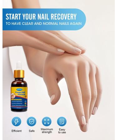 30ML Fungal nail repair fluid MYMULIKE toenail fungus repair extra strong nail repair solution for toenails and fingernails protects thick broken and discolored nails with - Buy Online on GoSupps.com