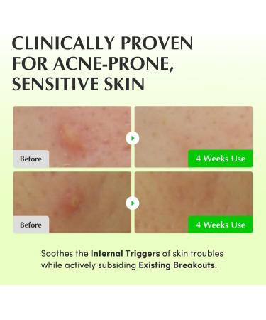 EQQUALBERRY Aloe PDRN Calming Toner for Sensitive | Instant Relief & Cooling | Non-Comedogenic & Fungal Acne Safe Skin Barrier Repair | K-Beauty (5.07 fl.oz / 150ml) - Buy Online on GoSupps.com