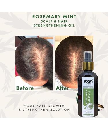 ican London Strengthening & Healthy Hair Growth Rosemary Mint Treatment Oil 150ml - Buy Online on GoSupps.com