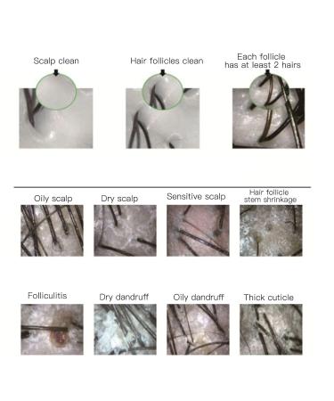 100X Magnification Skin Hair Scalp Detector | 2MP Camera Skin Health Analyser for Home & Salon Use - Buy Online on GoSupps.com