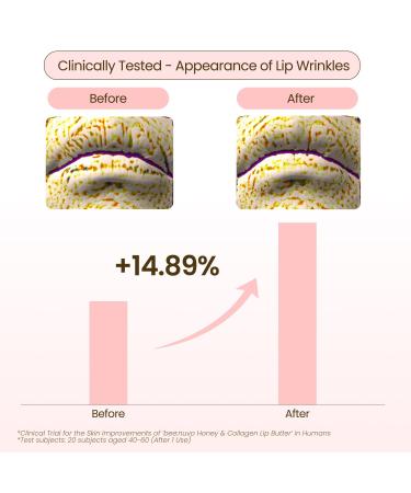 beenuvo Honey & Collagen Lip Butter Hydrating Lip Treatment Overnight Lip Mask Moisturizing Lip Balm with Jojoba Oil & Squalane Lip Care Korean Skin Care (0.45 oz) - Buy Online on GoSupps.com